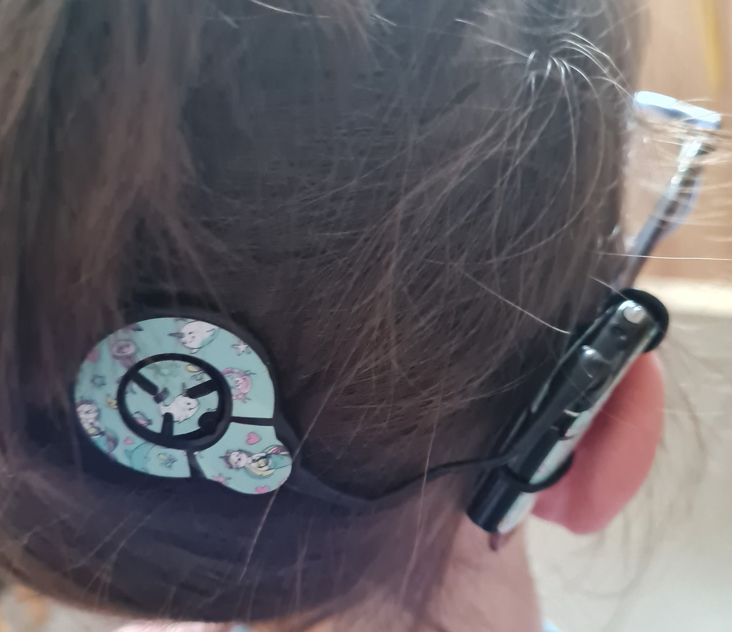 Accessoires fixation implants et prothèses pour les lunettes
