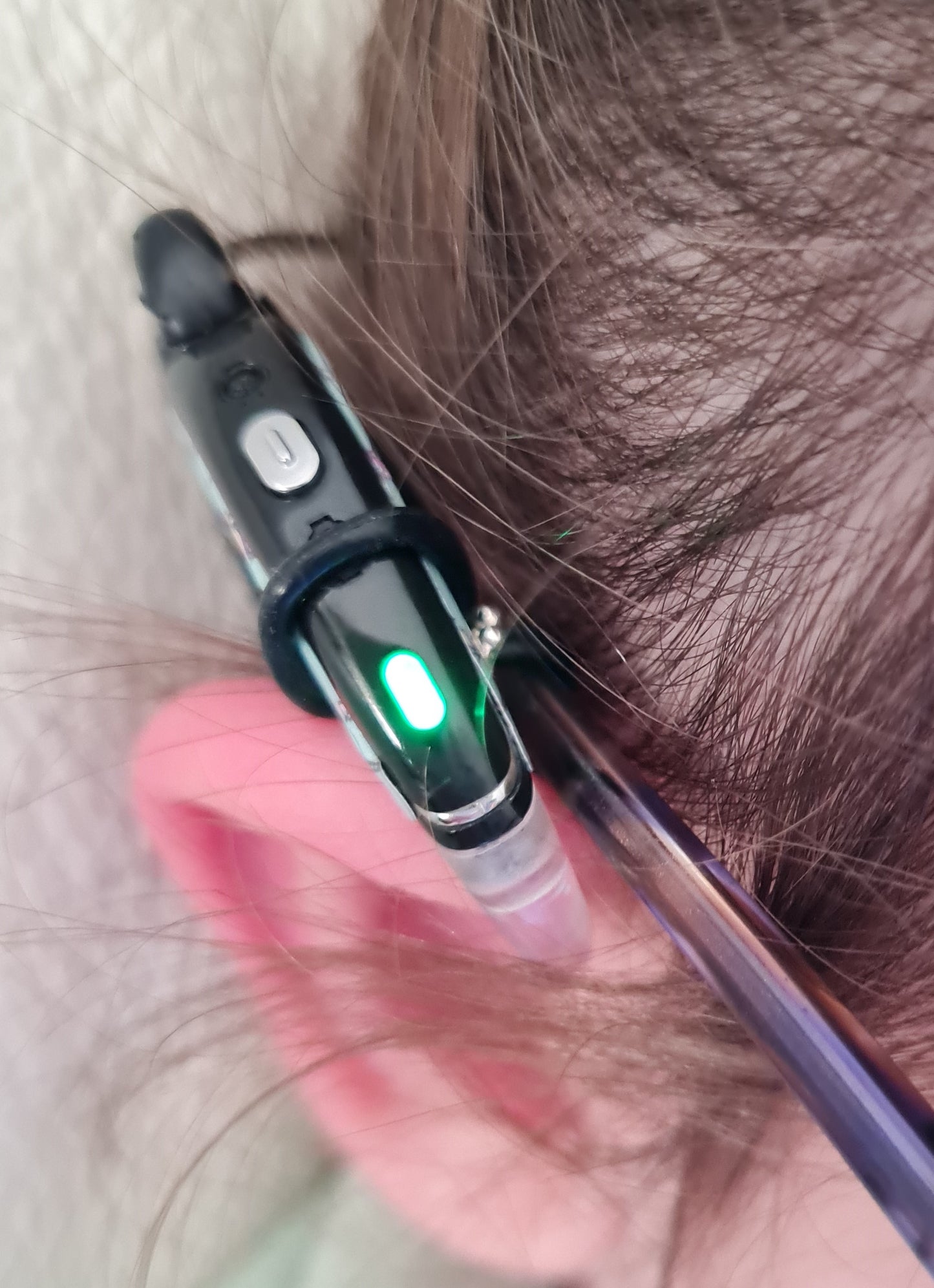 Accessoires fixation implants et prothèses pour les lunettes