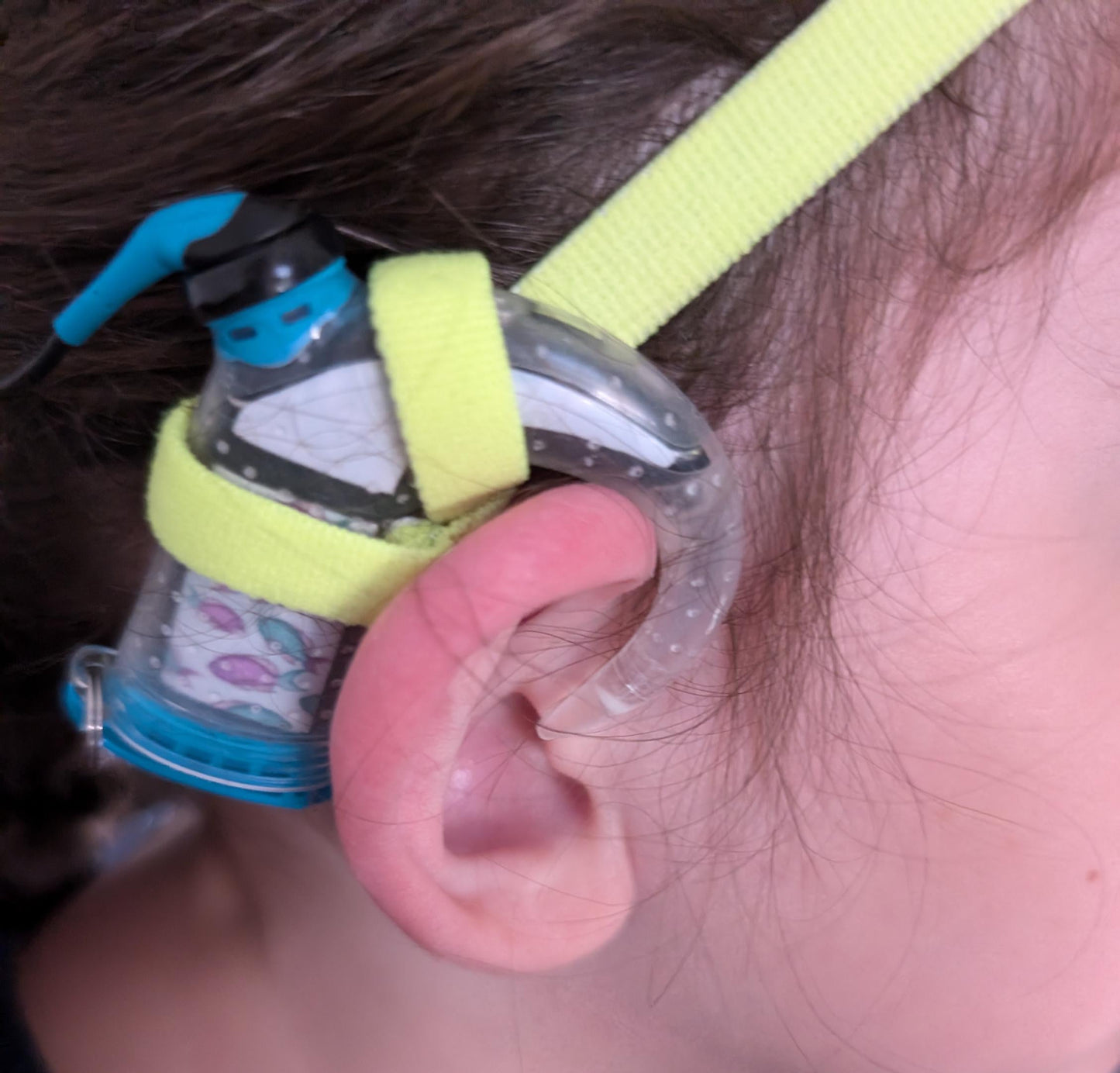 Bandeau antidérapant pour la natation et les sports aquatiques. Ideal Kit eau implant